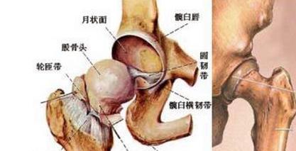 治疗狗股骨头坏死的有效药物（保护宠物健康）