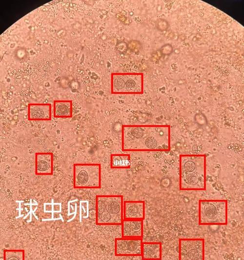 揭秘宠物狗大便虫卵长什么样（宠物爱好者必看）