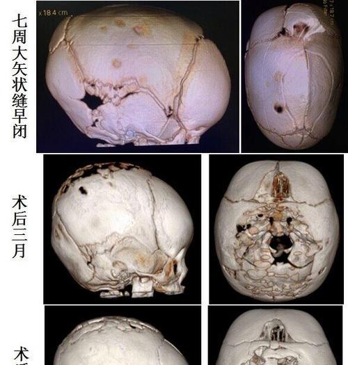 如何饲养狭颅田鼠（以宠物为主）